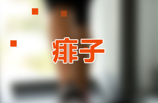 5大高招遠(yuǎn)離痱子