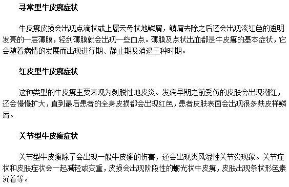 教你識別三種不同牛皮癬疾病的典型癥狀