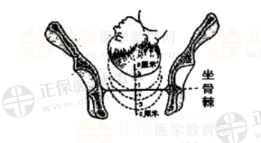 女性生殖系統(tǒng)考點(diǎn)速記